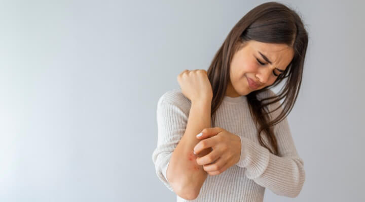 woman itching arm