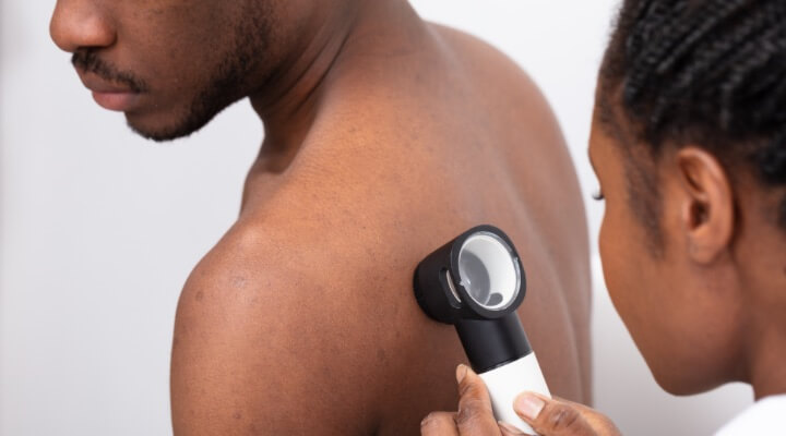 dermatologist inspecting mole