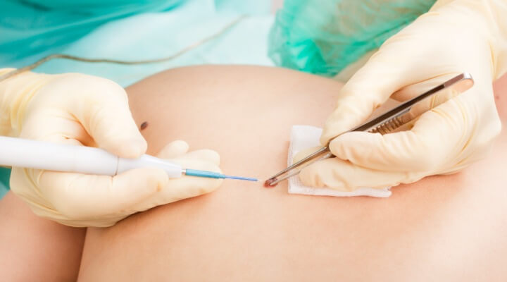 procedures-hero-image