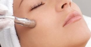 A Young Woman Undergoing The Microdermabrasion Procedure