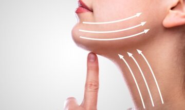 A Graph Showing How Kybella Removes Fat Under The Chin