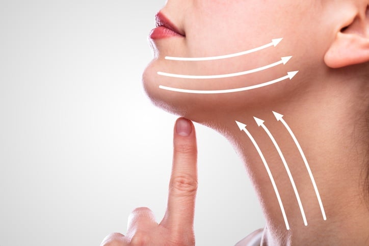 A graph showing how Kybella removes fat under the chin