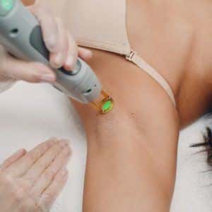 Dermatologist treating a patient with laser hair removal