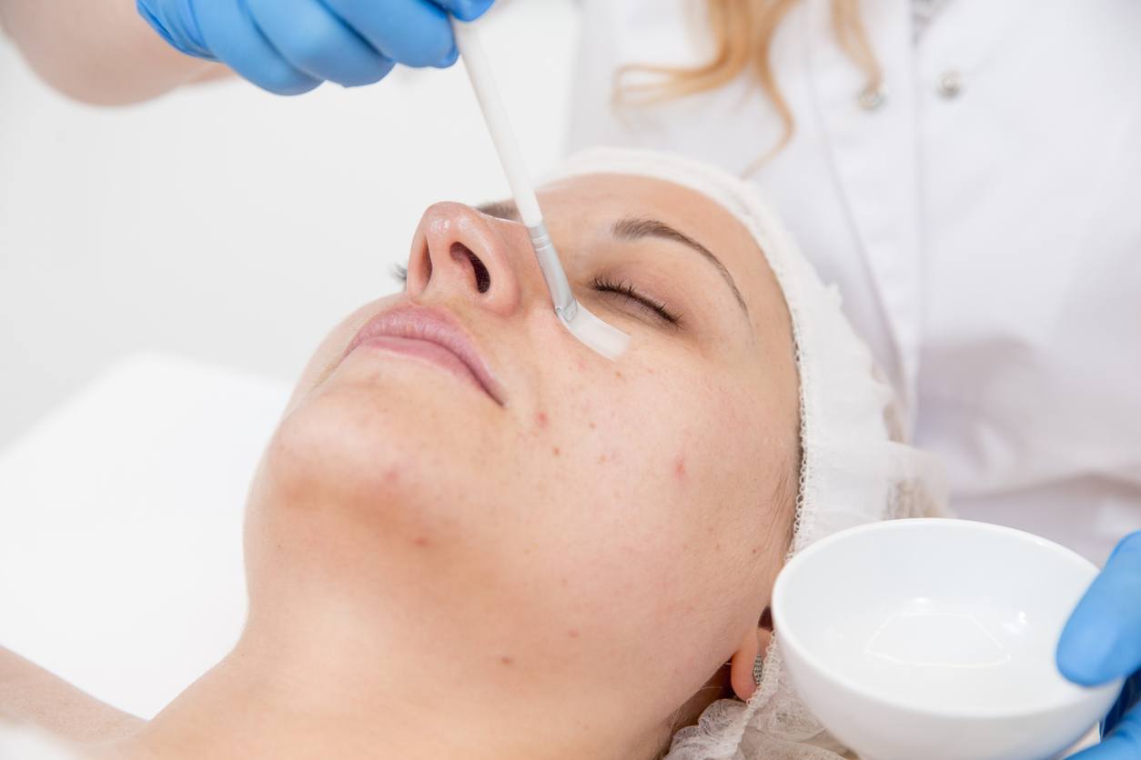 Dermatologist applying a chemical peel to a patient's face