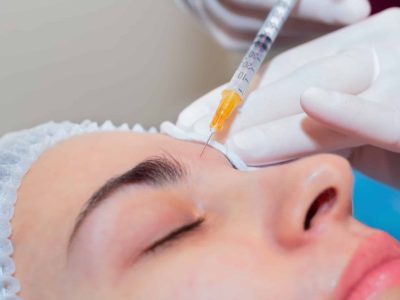 Needle Injecting Hyaluronic Acid Into The Forehead For Facial Rejuvenation